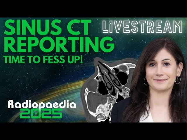 Sinus CT Reporting - Time to FESS Up!