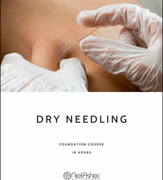 Trigger Point Dry Needling - IMS