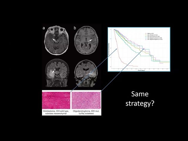 Transforming Tumor Methylation Profiling with Oxford Nanopore Direct DNA Sequencing