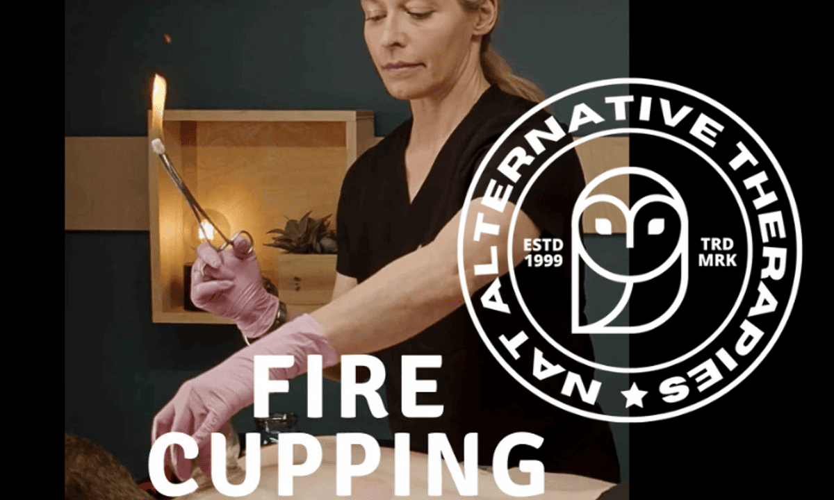 Fundamentals of Fire Cupping