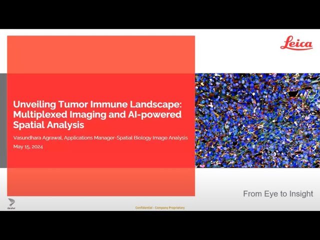 Unveiling Tumor Immune Landscape: Using Multiplexed Whole-Tissue Imaging and AI-Powered Spatial Analysis