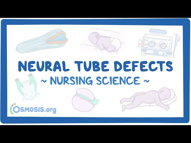 Neural Tube Defects - Clinical Nursing Care