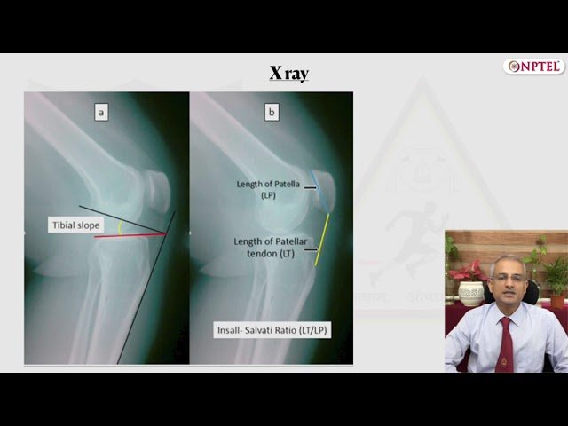 Radiological Evaluation of the Knee