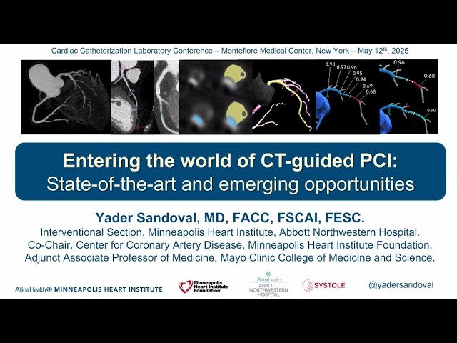 Entering the World of CT-guided PCI: State-of-the-art and Emerging Opportunities