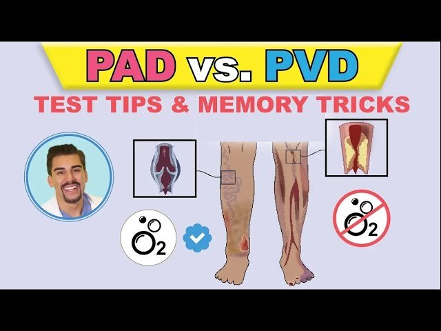 PAD vs PVI - Peripheral Arterial Disease Pathophysiology, Signs, and Memory Tricks