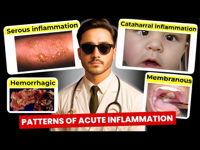Morphological Types of Acute Inflammation - General Pathology Patterns