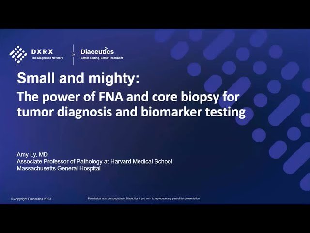 Small and Mighty - The Power of FNA and Core Biopsy for Tumor Diagnosis and Biomarker Testing