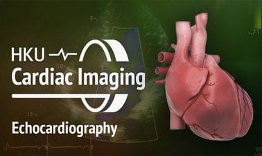 Advanced Cardiac Imaging: Echocardiography (Echo)