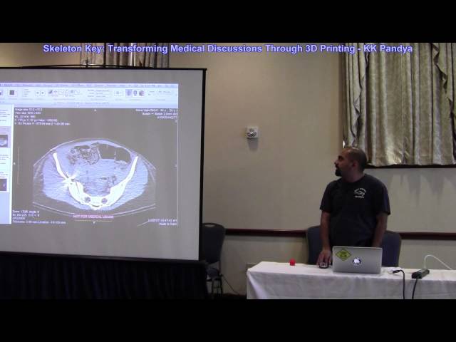 Transforming Medical Discussions Through 3D Printing