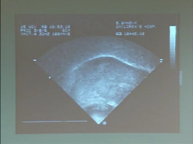 Extracting and Applying Measurements of Tongue Images