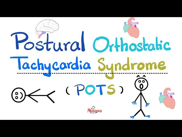Postural Orthostatic Tachycardia Syndrome (POTS) - Causes, Symptoms, Diagnosis, and Treatment