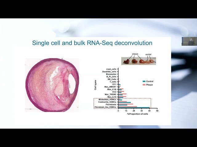 Multi-Omics View on Human Atherosclerosis