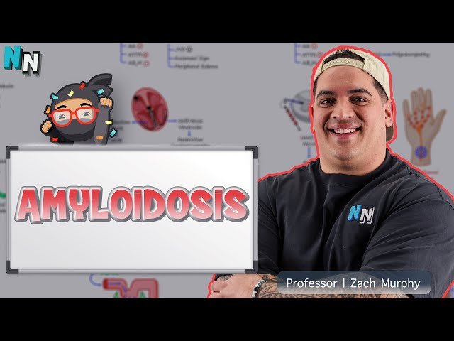 Amyloidosis - Clinical Medicine