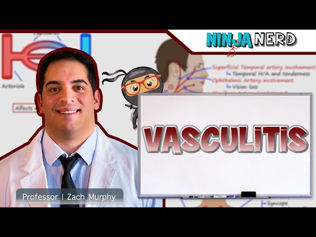 Vasculitis - Clinical Medicine