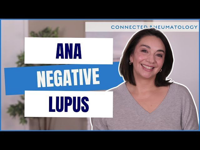 Understanding ANA-Negative Lupus: Testing, Diagnosis, and Treatment Approaches