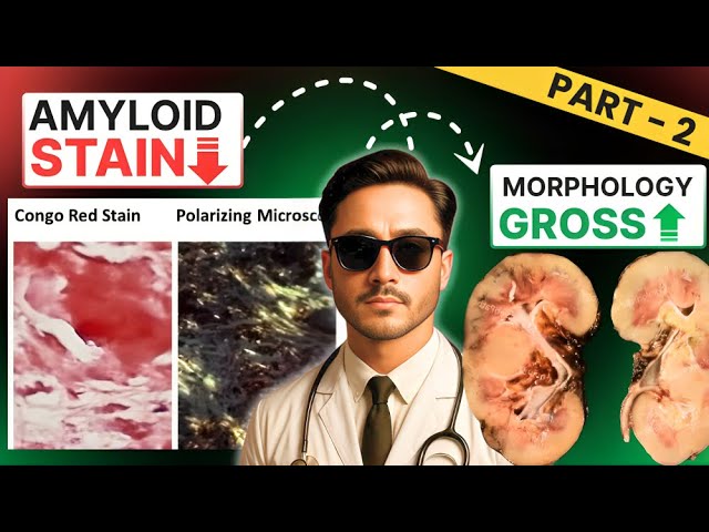 Amyloid Staining Procedure - Amyloidosis Histopathology in General Pathology