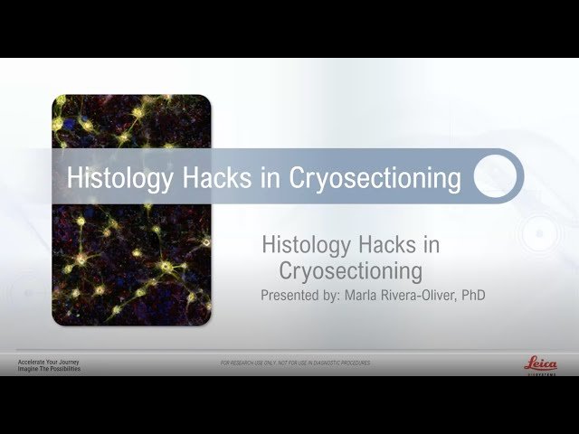 Histology Hacks for Cryosectioning - Essential Techniques and Automation Methods