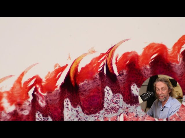 Histology of the Tongue