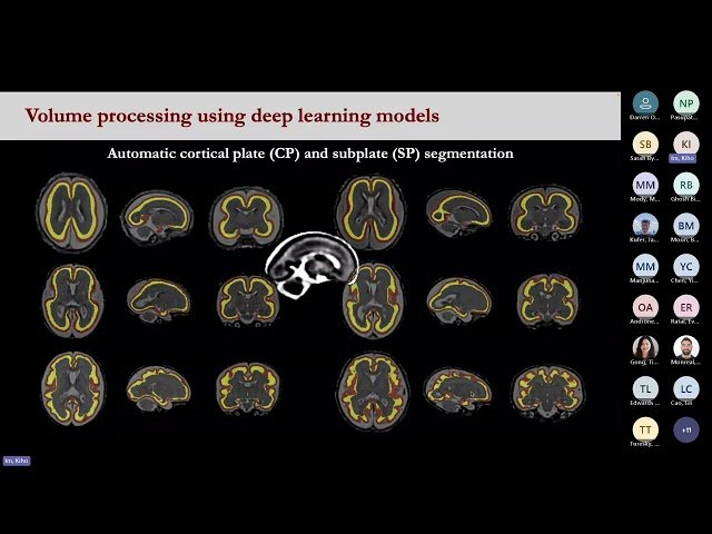 From Fetal MRI to Future Outcomes - Multimethod Insights into Early Human Brain Development