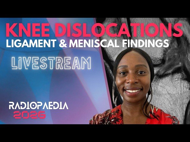 Knee Dislocation - Ligament and Meniscal Findings