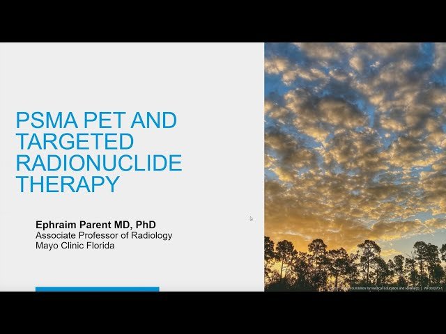 Molecular PSMA Imaging and Targeted Radionuclide Therapy of Metastatic Prostate Cancer