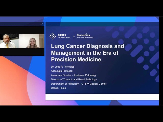 Lung Cancer Diagnosis and Management in the Era of Precision Medicine