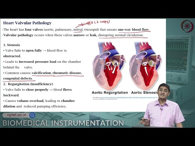Types of Biosignals - ECG - Part 4