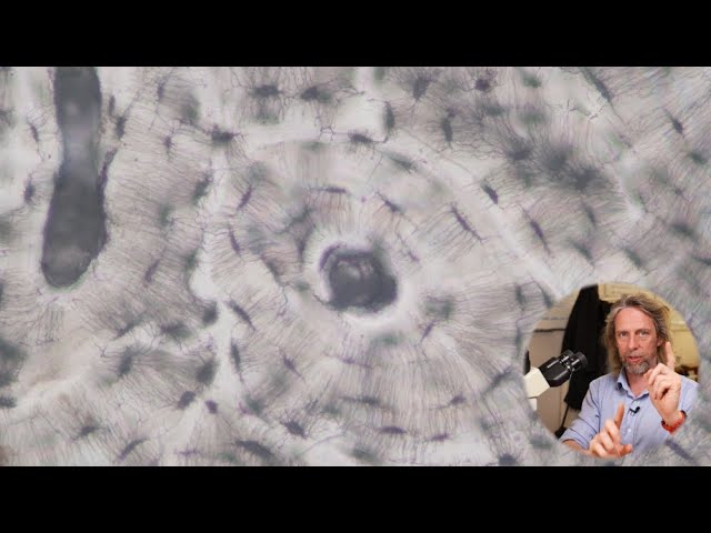 Histology of Bone: Structure, Cell Types, and Tissue Organization