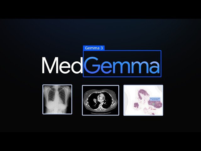 MedGemma - An Open Doctor Model