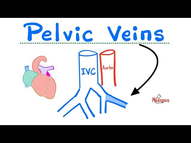 Veins of Pelvis - Internal Iliac, External Iliac, Gonadal - Anatomy of Pelvis and Perineum