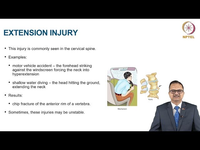 Spine Injuries
