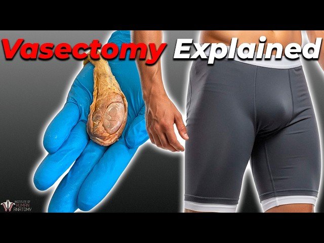 The Actual Effects of Having a Vasectomy