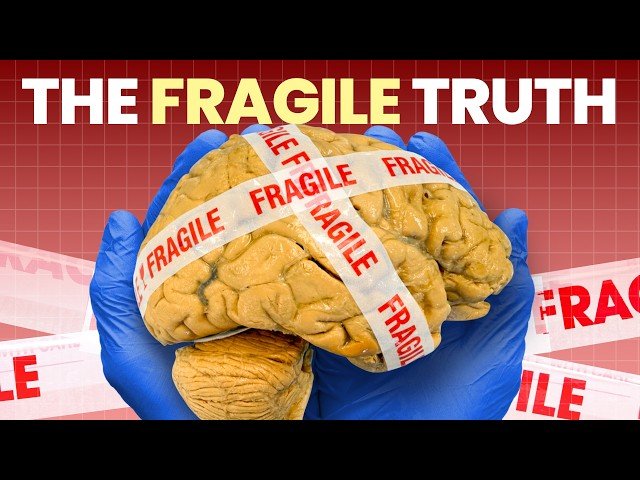 Your Brain is Too Fragile to Stand Up - It Has to Float to Survive