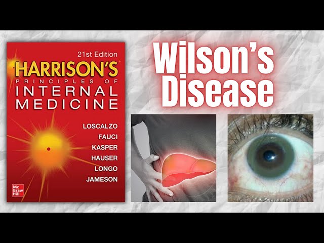 Wilson's Disease - Pathophysiology, Clinical Manifestations, and Management