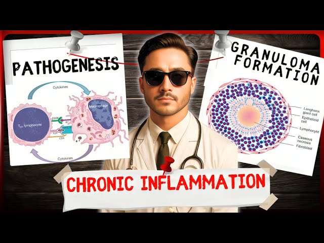 Chronic Inflammation Pathology - Granulomatous Inflammation and Granuloma Formation