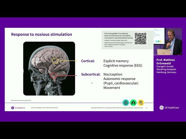 Is Tailored Anaesthesia Needed? Advantages of Adequacy of Anaesthesia Monitoring