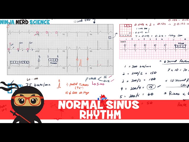 Electrocardiogram (ECG) - Rate and Rhythm Analysis