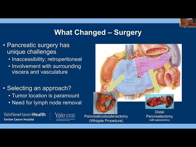 Oncovascular Surgery at Yale