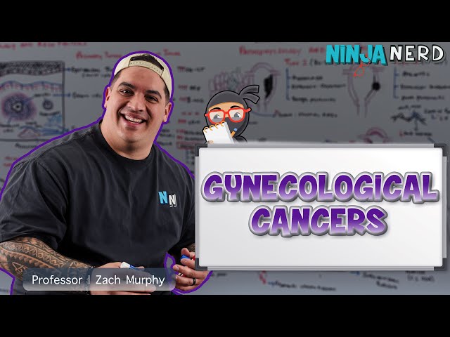 Gynecological Cancers - Clinical Medicine