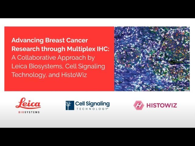 Advancing Breast Cancer Research Through Multiplex IHC - A Collaborative Approach