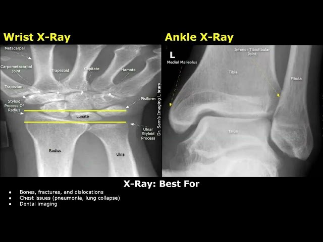 The Difference Between Ultrasound, X-Ray, CT Scan and MRI - How They Work, Advantages and Disadvantages