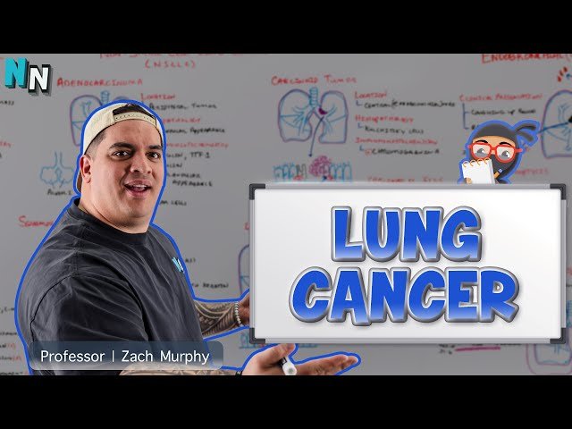 Lung Cancer - Clinical Medicine