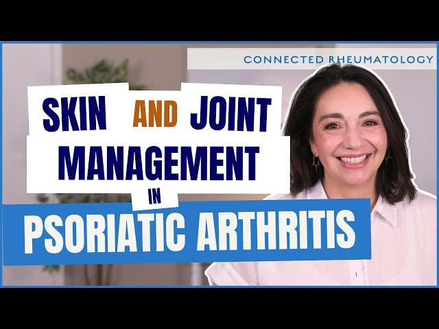 Managing Psoriatic Arthritis - A Guide to Coordinating Skin and Joint Treatment