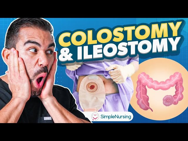 Colostomy and Ileostomy Nursing - Indications, Complications, Care
