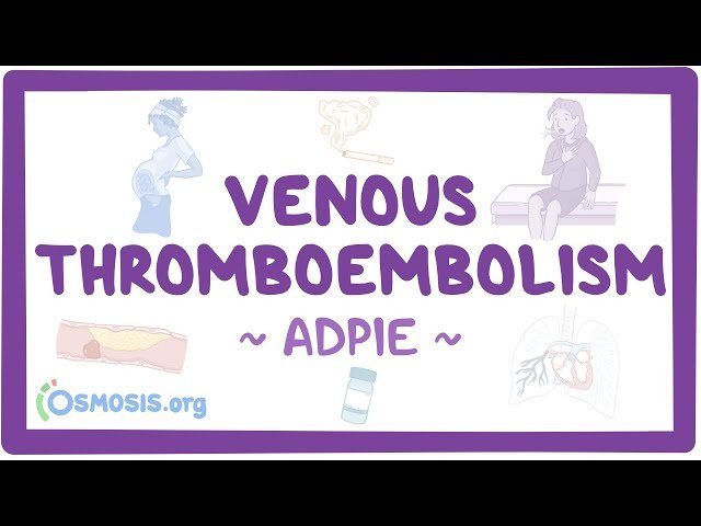 Venous Thromboembolism (VTE) - Nursing Process (ADPIE)