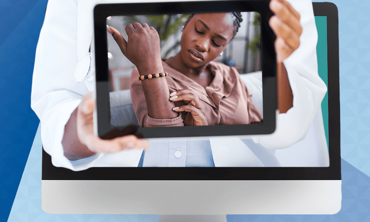 Telehealth: Dermatology Assessment