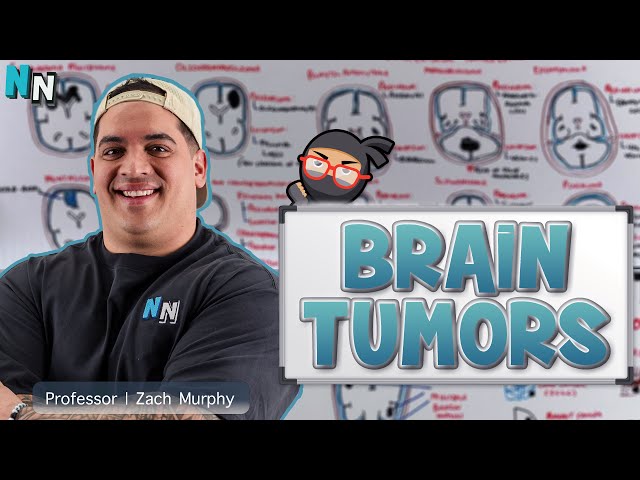 Brain Tumors - Clinical Medicine
