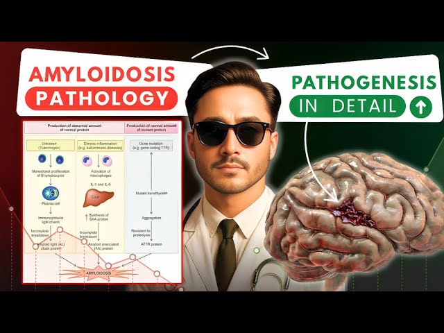 Amyloidosis Pathology - Primary and Secondary Amyloidosis Classification