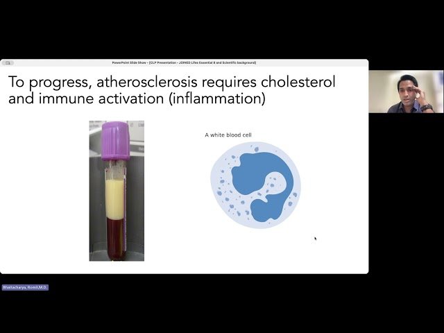 Be Heart Smart - Lifestyle Changes for Heart Health