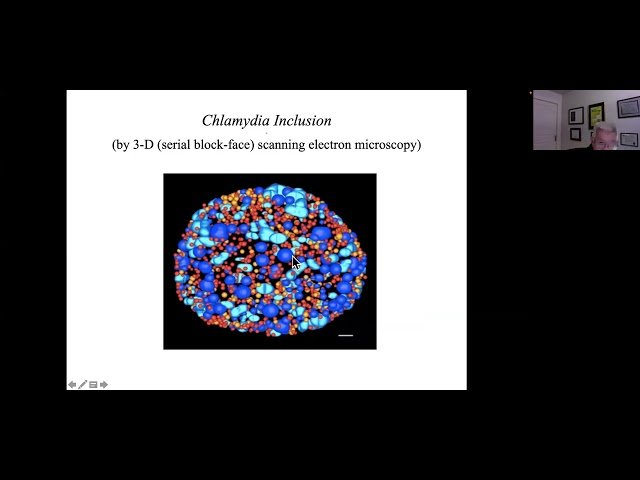 Growth of Reticulate Body (RB) Population in the Conversion Phase of Chlamydia Life Cycle